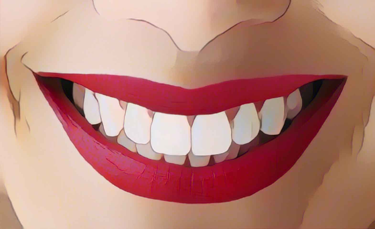 Dental